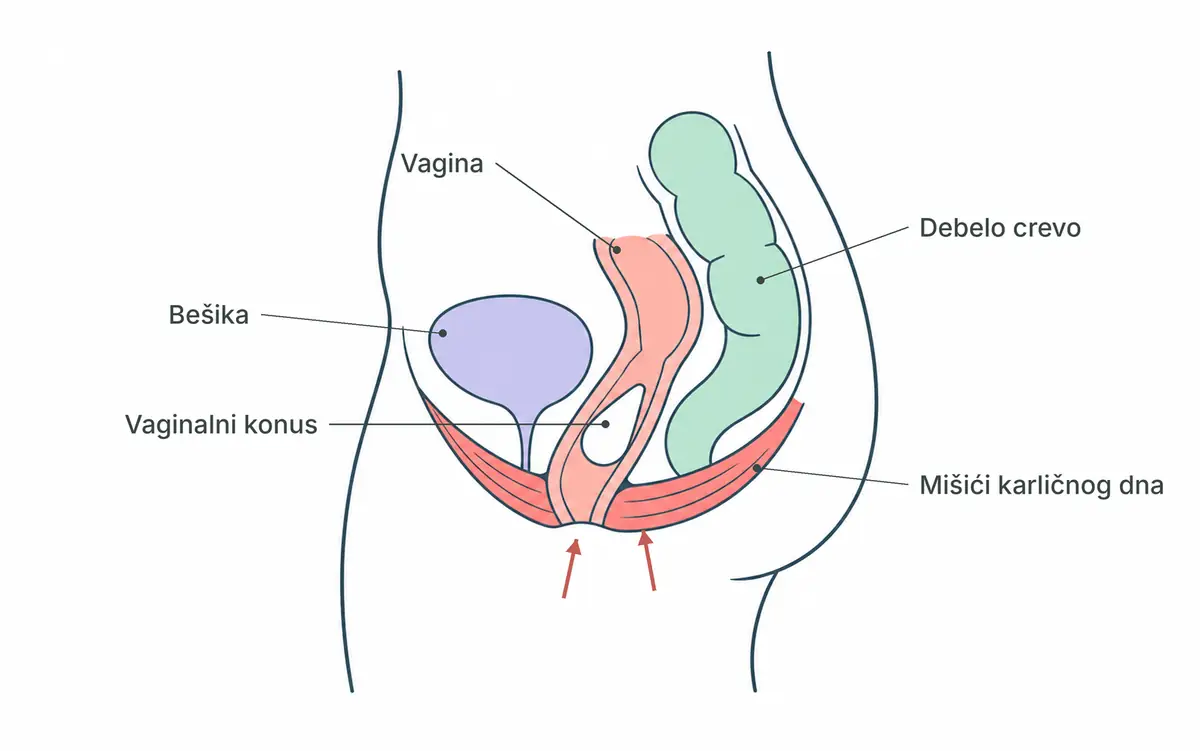 Presek ženske karlice: vaginalni konus u vagini i mišići karličnog dna koji ga zadržavaju
